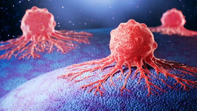 Kazia Therapeutics: Upcoming Data May Validate Best-In-Class Potential Of Paxalisib (NASDAQ:KZIA)