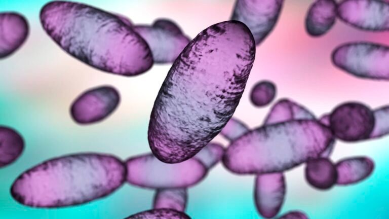 Russia plague: Global risk may be low, but experts want more data